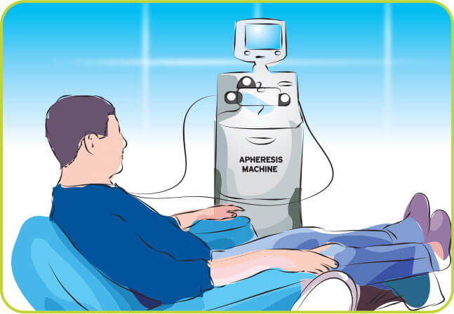 A diagram showing a male at an apheresis machine for stem cell collection.