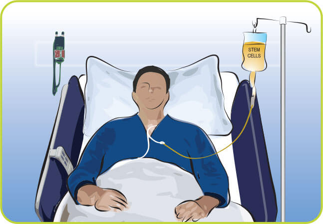 A diagram of a male in bed getting a stem cell transplant.